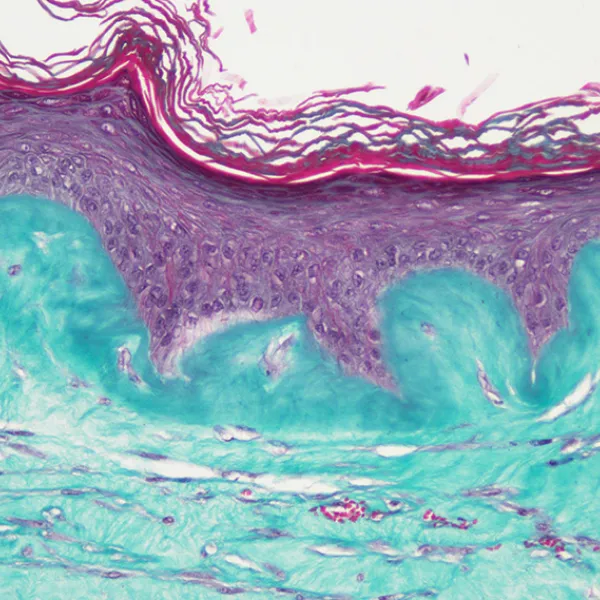 Bioprinted full-thickness skin models