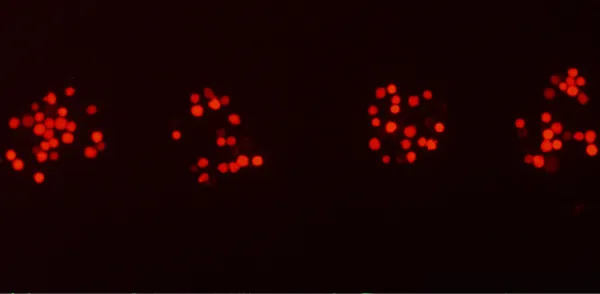 High-resolution laser bioprinting