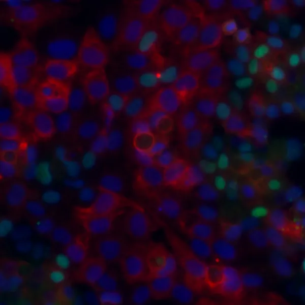 Bioprinted liver tissue