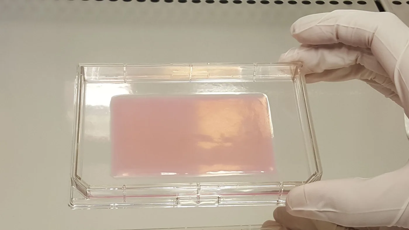 Poieskin® bioprinted skin substitute